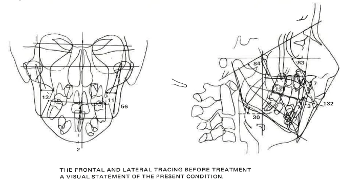 Manual Illustration